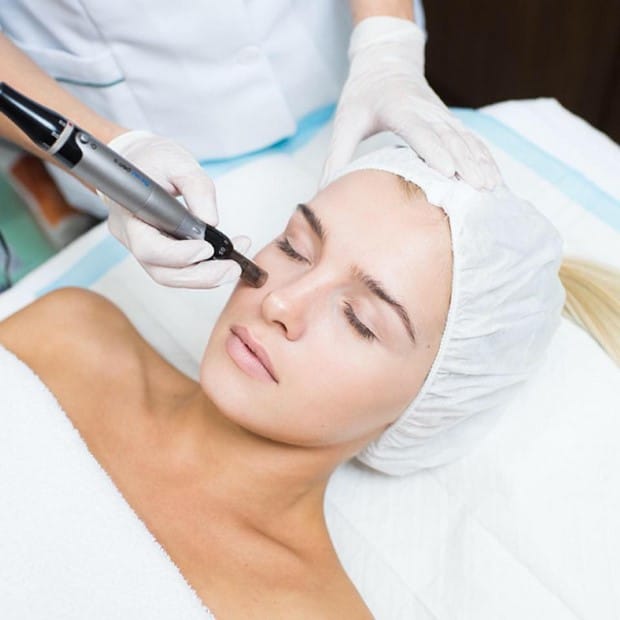 Microneedling à Bruxelles, soin révolutionnaire pour la peau chez Aestetic