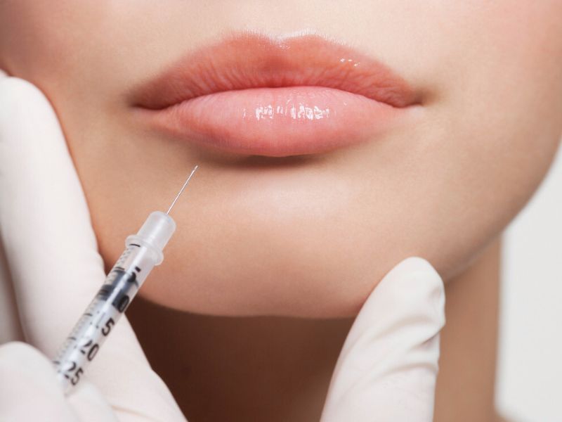 Injection acide hyaluronique ou Botox