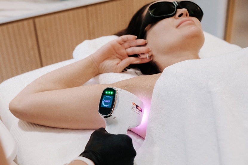 Épilation laser Bruxelles traitement efficace contre les poils