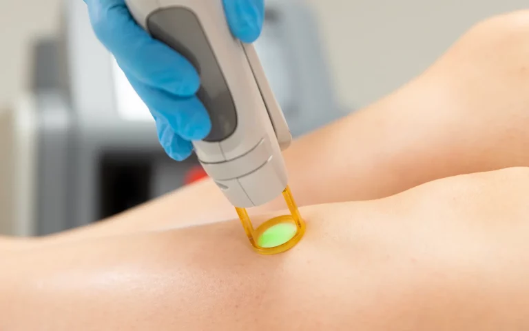 Choisissez Épilation Laser Définitive Bruxelles pour réduire durablement les poils. Découvrez les résultats et réservez votre consultation.