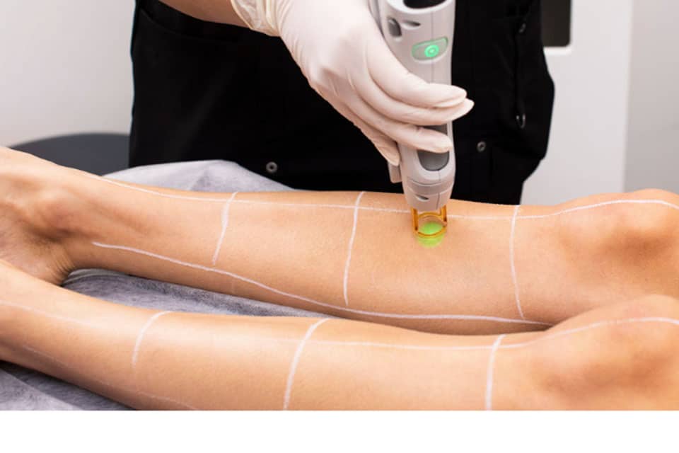 Choisissez Épilation Laser Définitive Bruxelles pour réduire durablement les poils. Découvrez les résultats et réservez votre consultation.