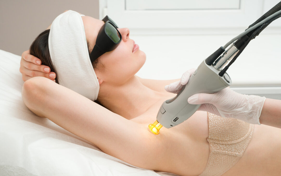 Épilation laser Bruxelles : quelle méthode choisir pour une peau durablement lisse ?