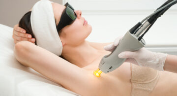 Épilation laser Bruxelles : quelle méthode choisir pour une peau durablement lisse ?