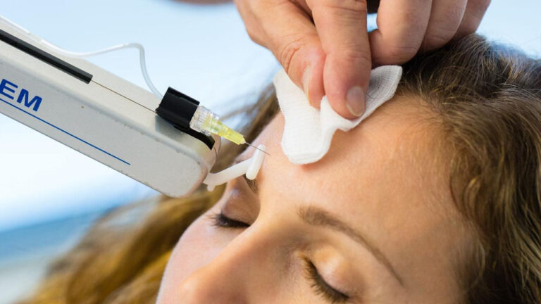 Mésothérapie visage prix, indications, bénéfices et conseils : découvrez quels profils peuvent profiter de ce soin revitalisant pour la peau. Mésothérapie visage prix, indications, bénéfices et conseils : découvrez quels profils peuvent profiter de ce soin revitalisant pour la peau.