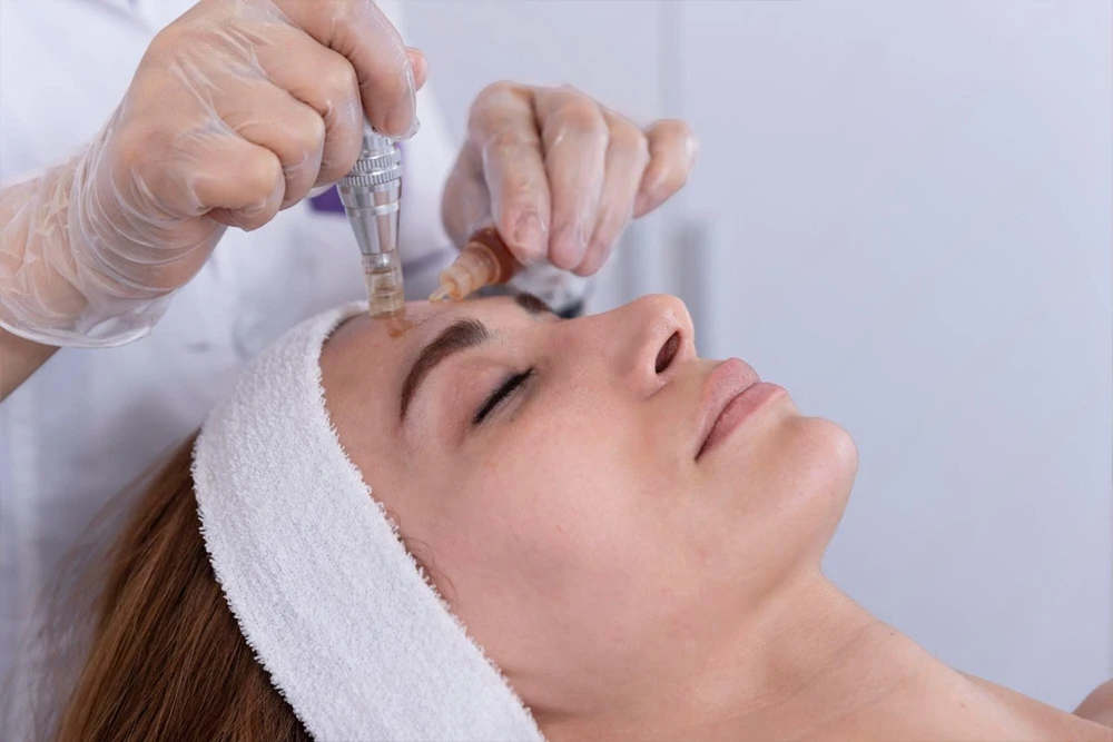 Mésothérapie visage : à qui s’adresse ce soin revitalisant ?