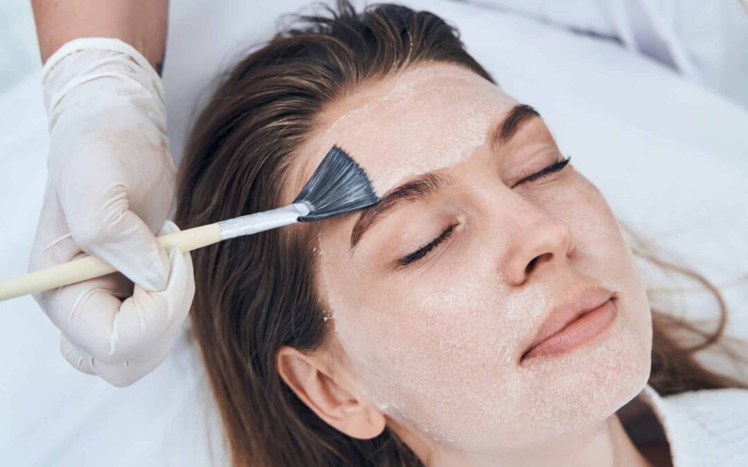 Peeling chimique visage : comment se déroule une séance et quels résultats attendre ?