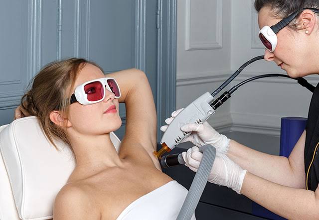Épilation au laser Bruxelles : quelles zones du corps peut-on traiter ?