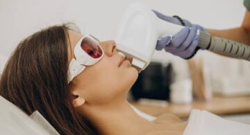 Laser CO2 Bruxelles : comment fonctionne ce traitement et pour quelles imperfections ?