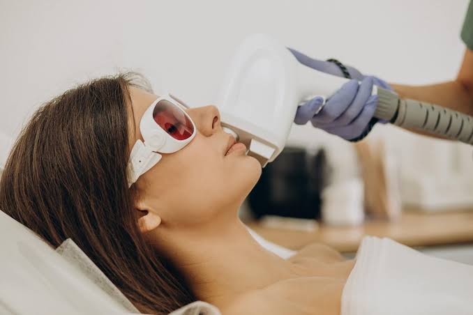 Laser CO2 Bruxelles : comment fonctionne ce traitement et pour quelles imperfections ?