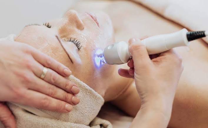 Laser CO2 Bruxelles : comment fonctionne ce traitement et pour quelles imperfections ?
