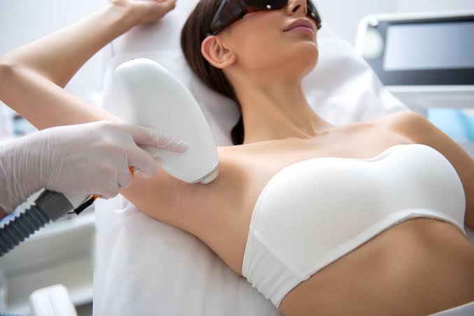 Épilation laser Bruxelles : quelle méthode choisir pour une peau durablement lisse ?