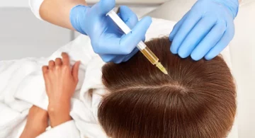 PRP visage et cheveux : quels sont les bienfaits de ce traitement régénératif ?