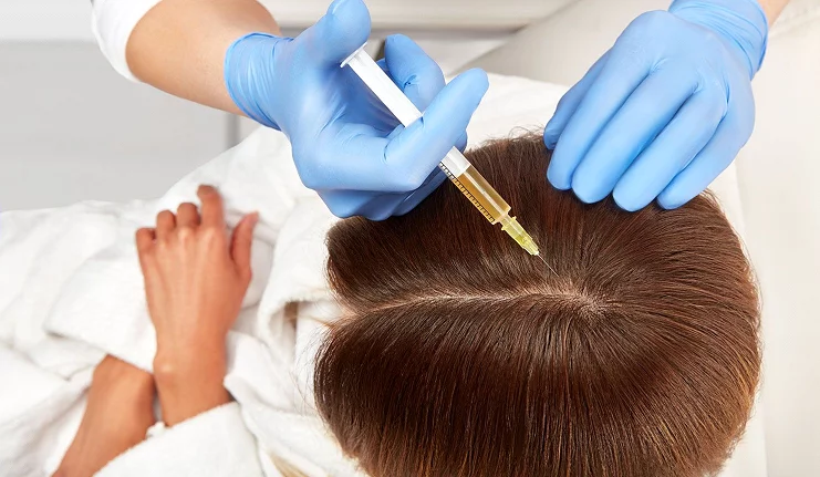PRP visage et cheveux : quels sont les bienfaits de ce traitement régénératif ?